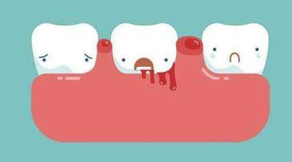 Ϊʲôҽ�����Ƽ�ϴ�� ��Щ�˲��ʺ�ϴ��